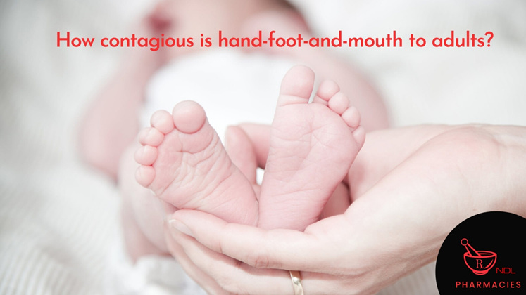 How contagious is hand-foot-and-mouth to adults?