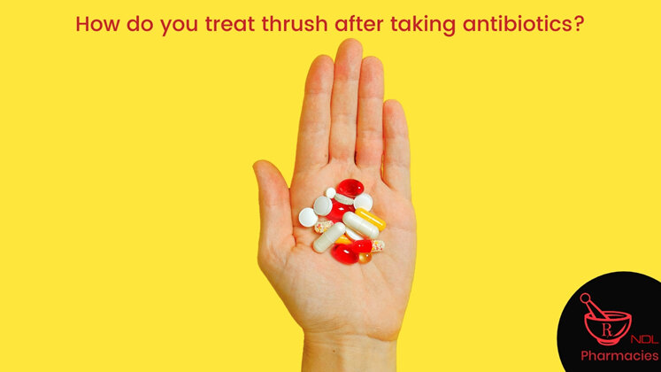 How do you treat thrush after taking antibiotics?