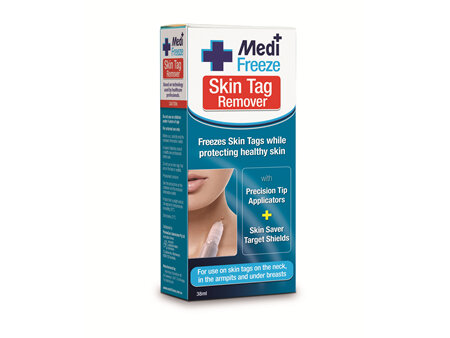 Medi Freeze Skin Tag Remover