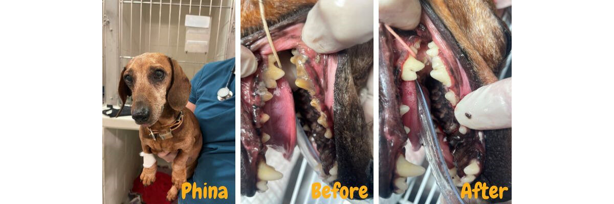 Phina's before & after smile