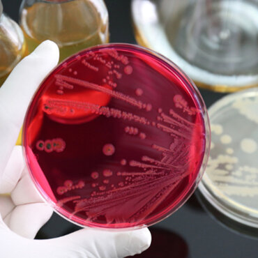 Salmonella growing on a petrie dish