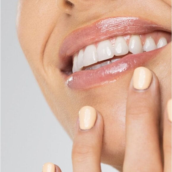 Teeth Whitening - Smile Goals!