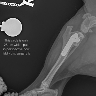 X-ray of Holly's surgery